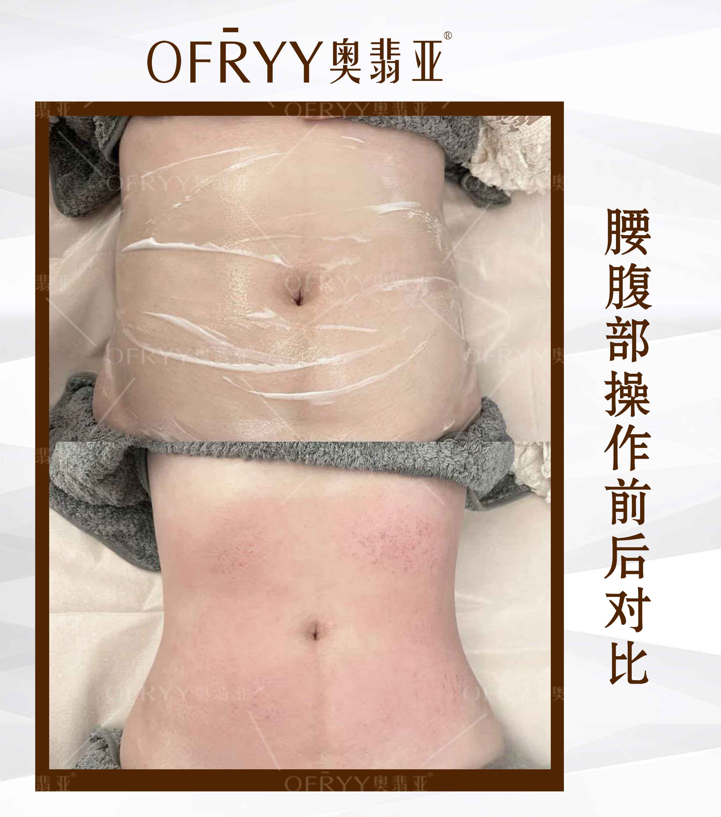 案例对比